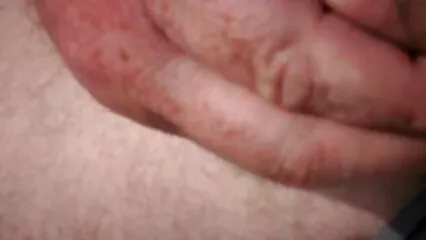 tear ass